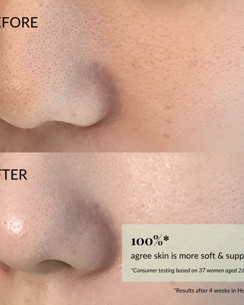 Close-up of a nose and cheek before and after using IREN Shizen FLOWERS IN BLOOM Antioxidant Water Cream; "after" image shows visibly smoother, softer skin with a 100% improvement claim in the corner.