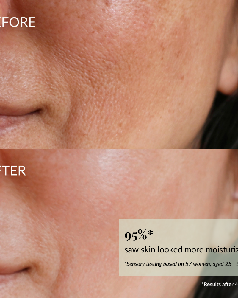 Close-up of a woman's cheek and mouth area shows plumper, less dry skin in the "after" image, demonstrating the moisturizing results of IREN Shizen QUENCH-UP Hydrating Serum.